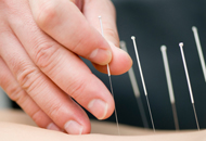 Rochester, NY Acupuncture